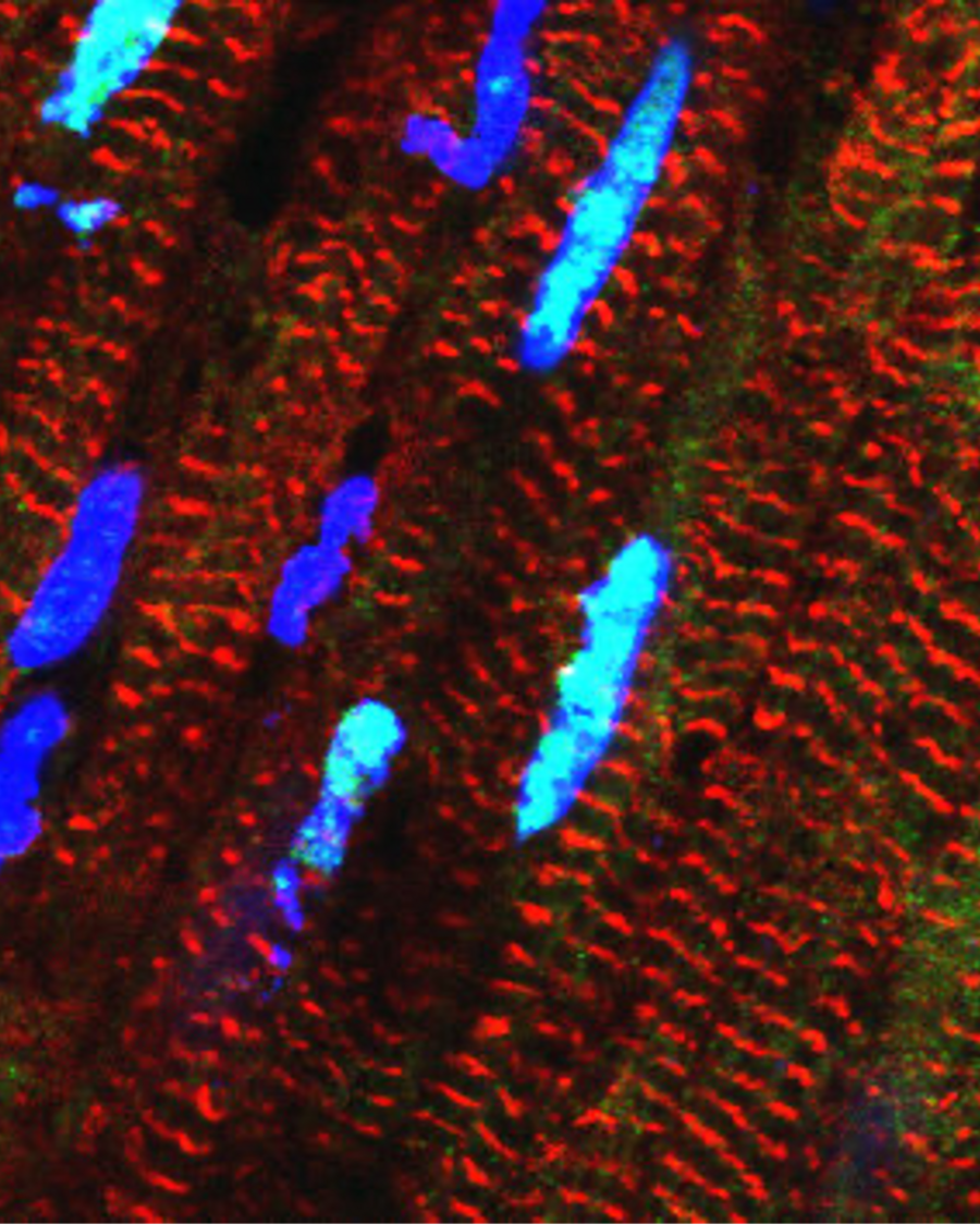 © Michael Radke, Max Delbrück Center